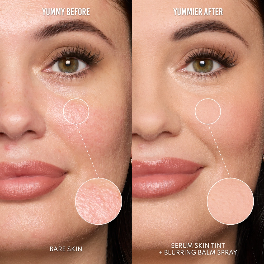 What Else You Need To Know